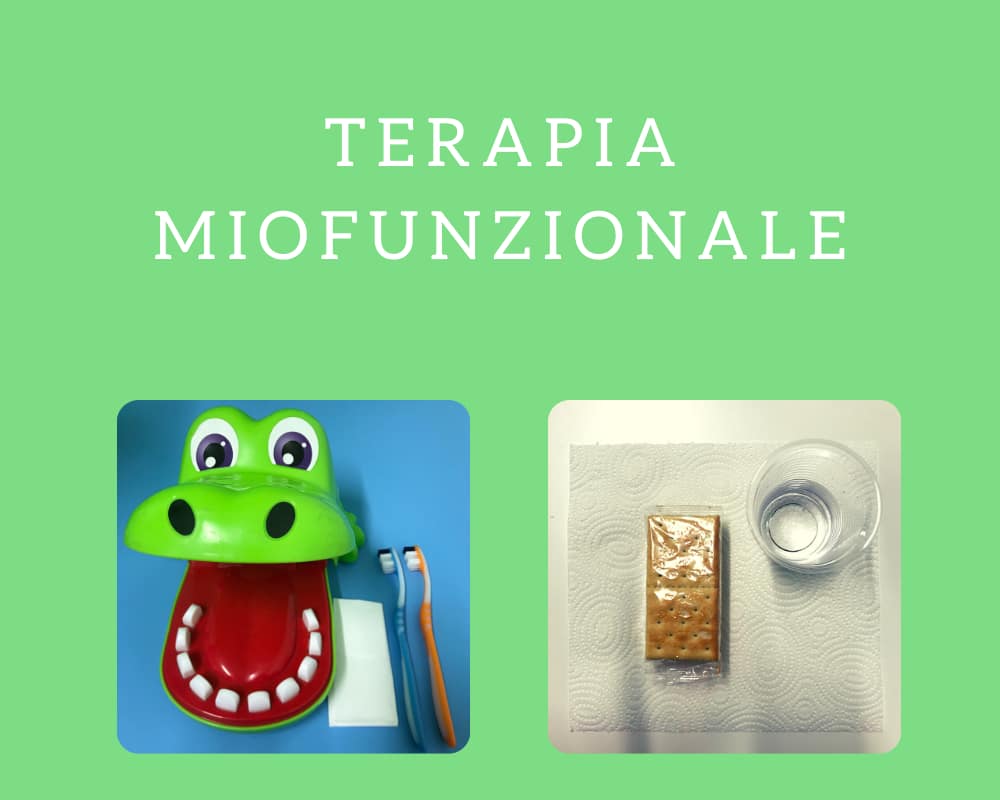 terapia miofunzionale cos'è