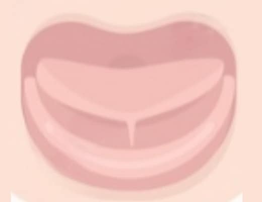 cosa fare frenulo linguale corto